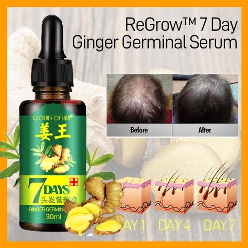 7 Days Ginger Germinal Oil for fast hair growth