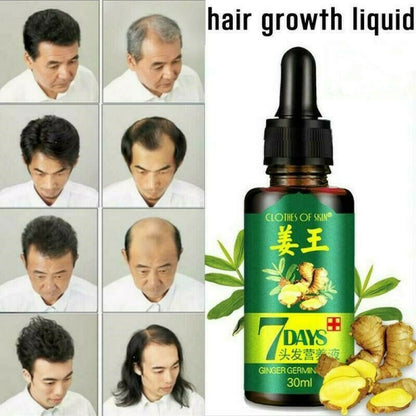 7 Days Ginger Germinal Oil for fast hair growth