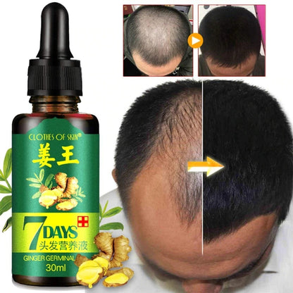 7 Days Ginger Germinal Oil for fast hair growth