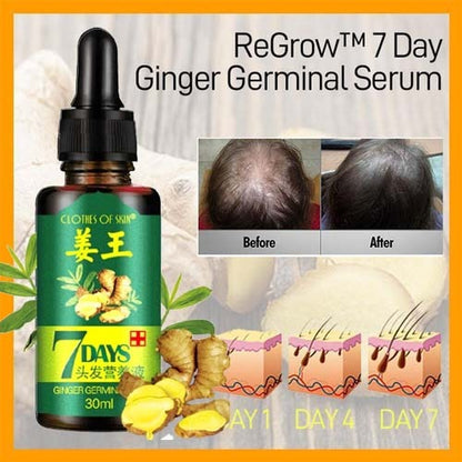 7 Days Ginger Germinal Oil for fast hair growth