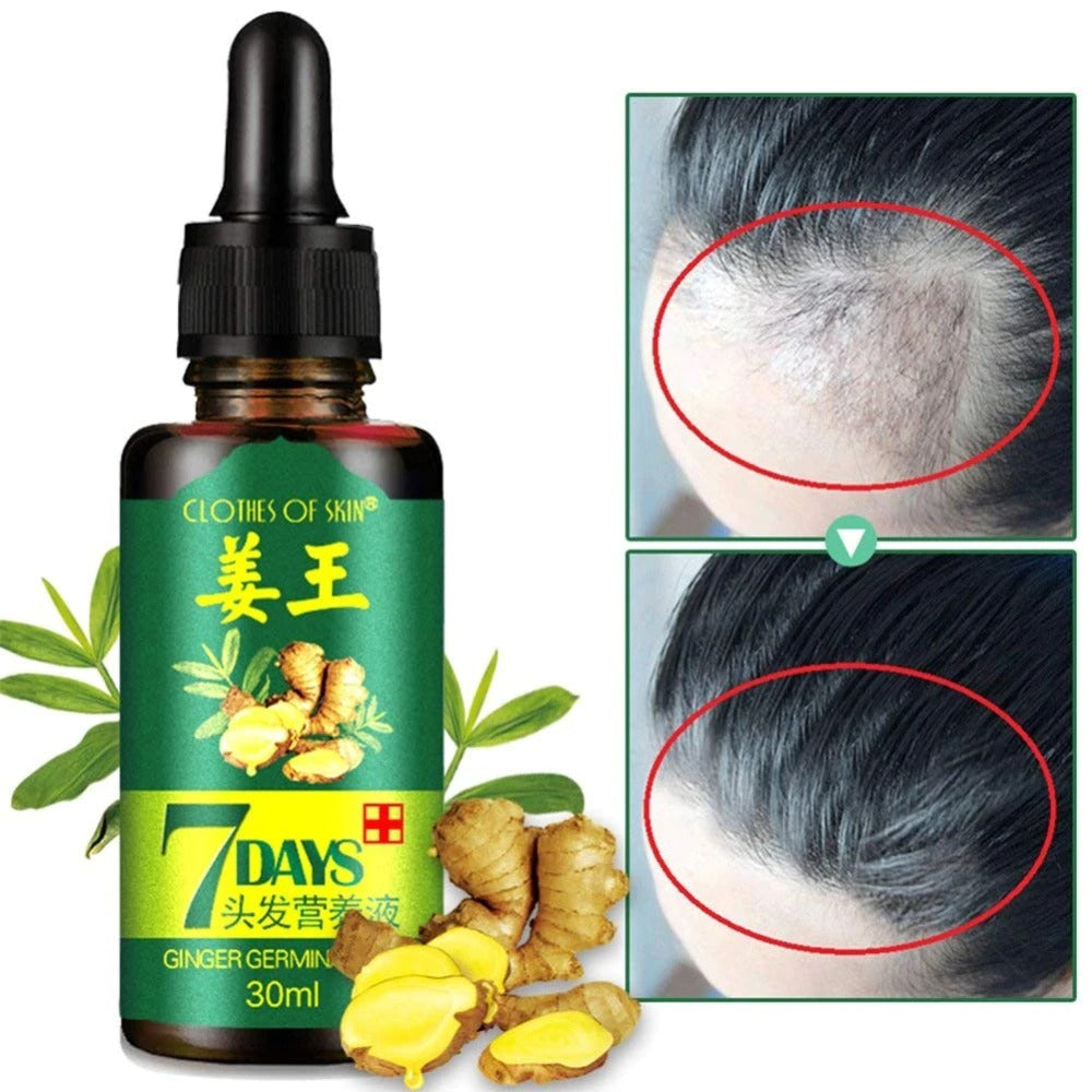 7 Days Ginger Germinal Oil for fast hair growth