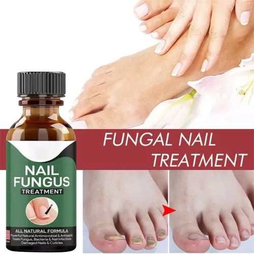 Effective Nail Repair & Fungus Treatment Serum (10ml)