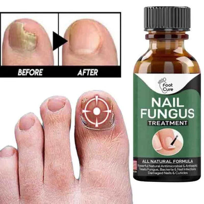 Effective Nail Repair & Fungus Treatment Serum (10ml)