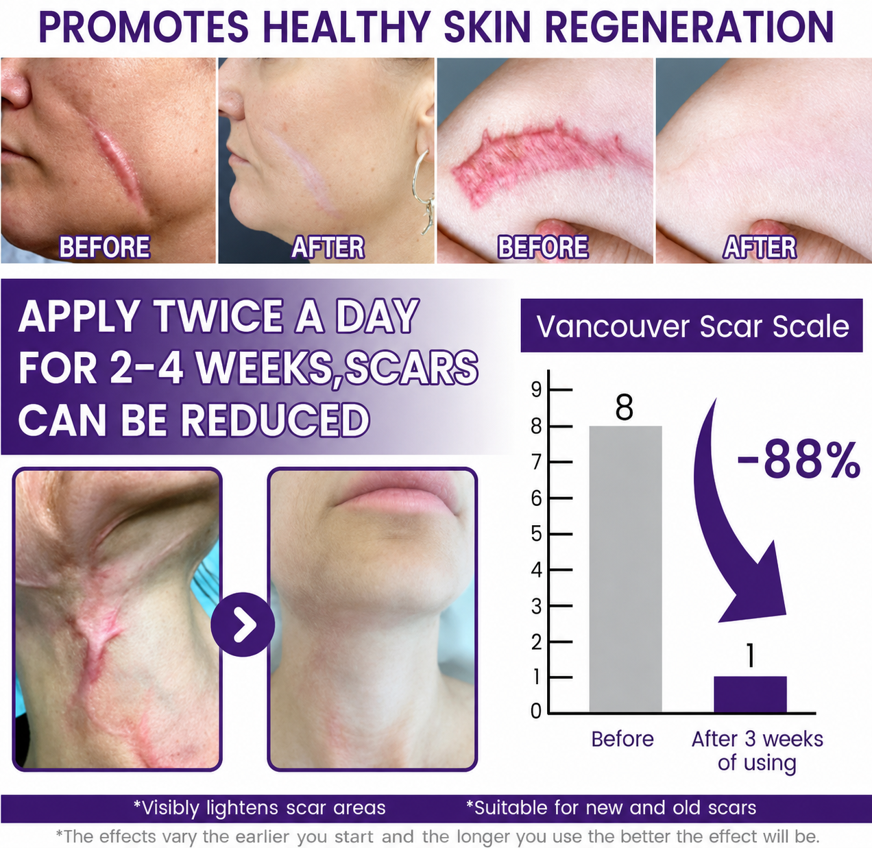 TiMilk - ReGen Scar Stem Cell Repair Gel (Imported)