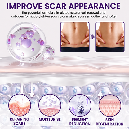 TiMilk - ReGen Scar Stem Cell Repair Gel (Imported)