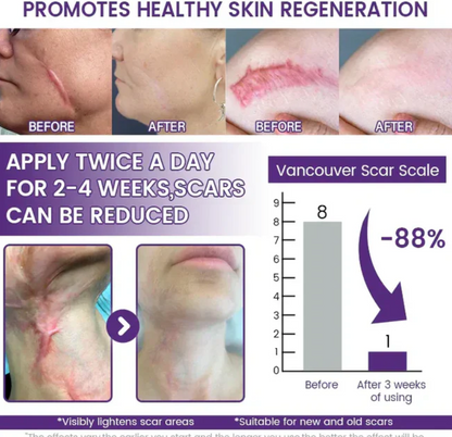 TiMilk - ReGen Scar Stem Cell Repair Gel (Imported)