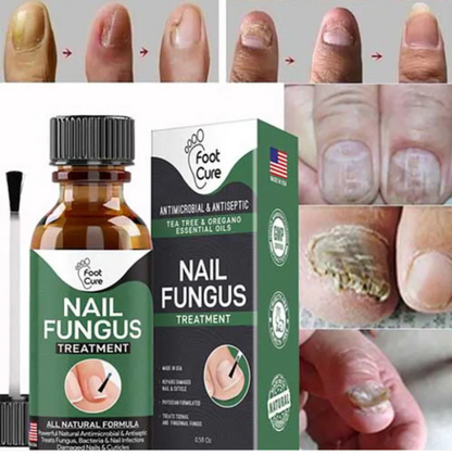 Effective Nail Repair & Fungus Treatment Serum (10ml)