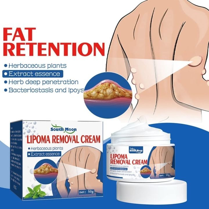 Lipoma Removal Cream for Fat Retention & Herbicide Action
