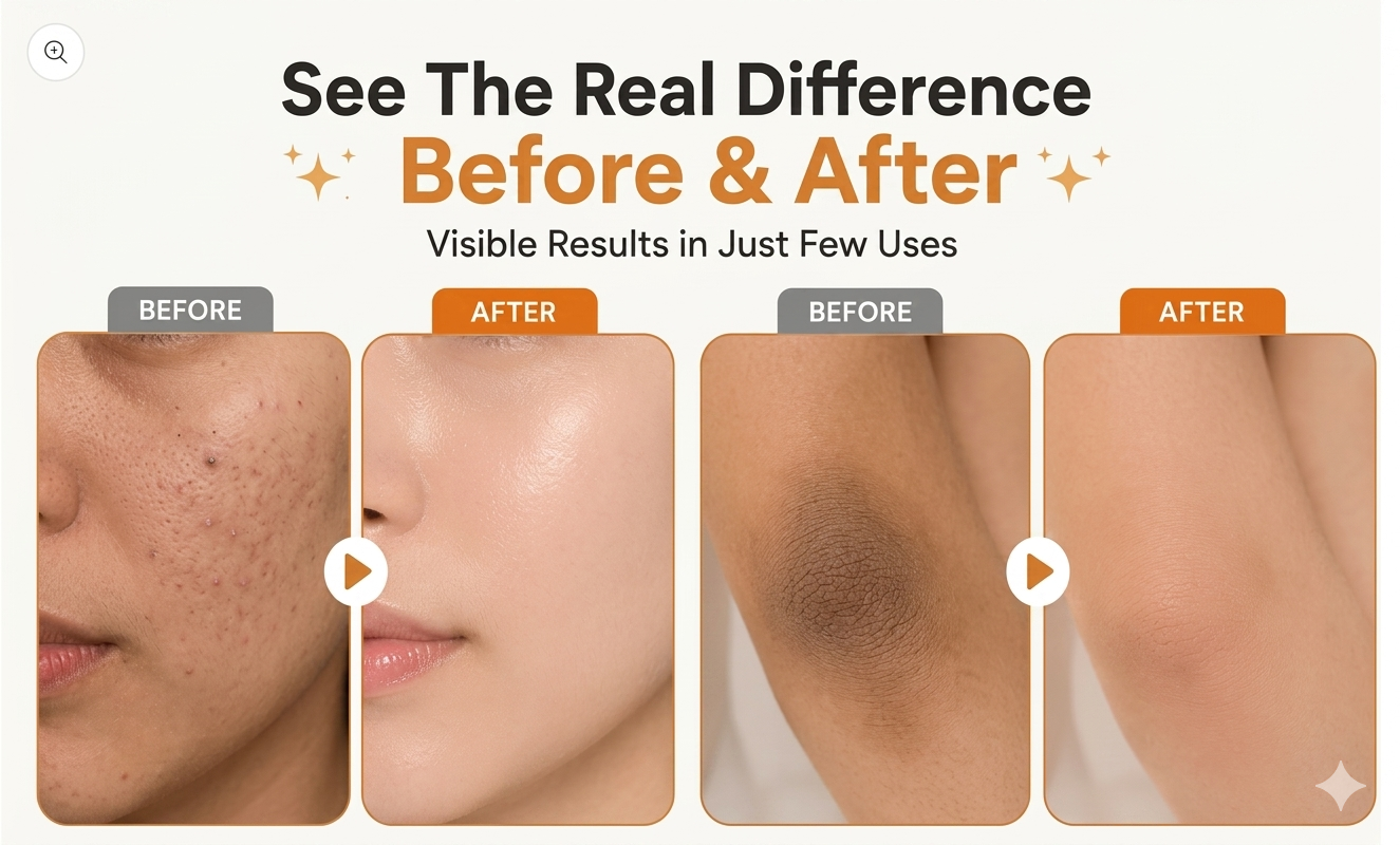 ORANGE EXFOLIATING WHITENING GEL – DARK SPOT & DEAD SKIN REMOVER