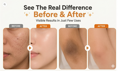 ORANGE EXFOLIATING WHITENING GEL – DARK SPOT & DEAD SKIN REMOVER